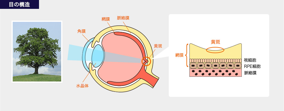 変性 加 齢 黄斑