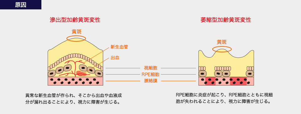 原因