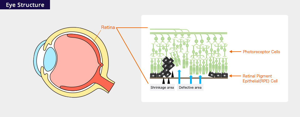 The retina and retinal pigment epithelium (RPE)