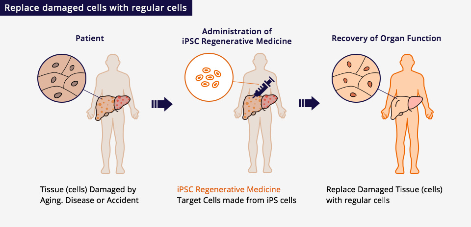 Replace damaged cells with regular cells