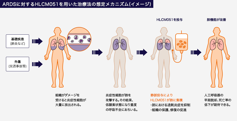 急性呼吸窮迫症候群 Ards 株式会社ヘリオス