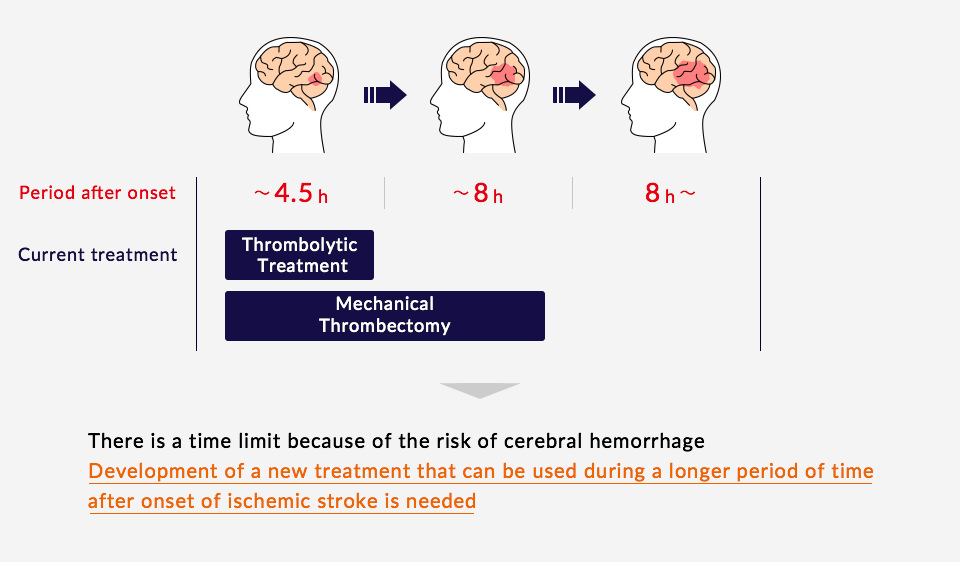 Ischemic Stroke Healios K K