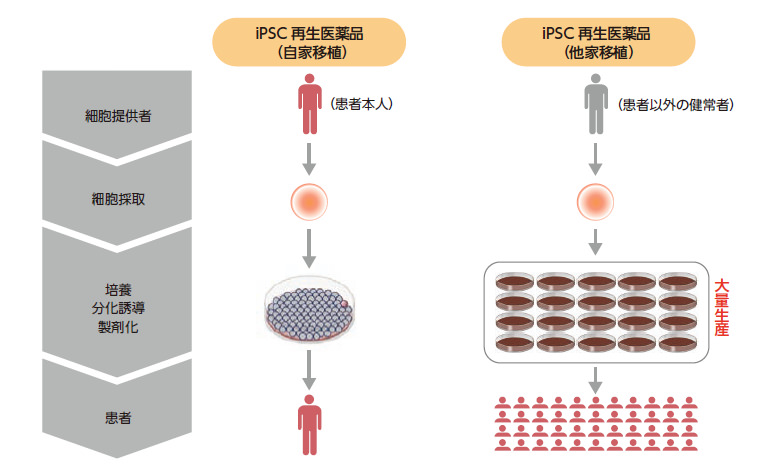 自家移植と他家移植の違い