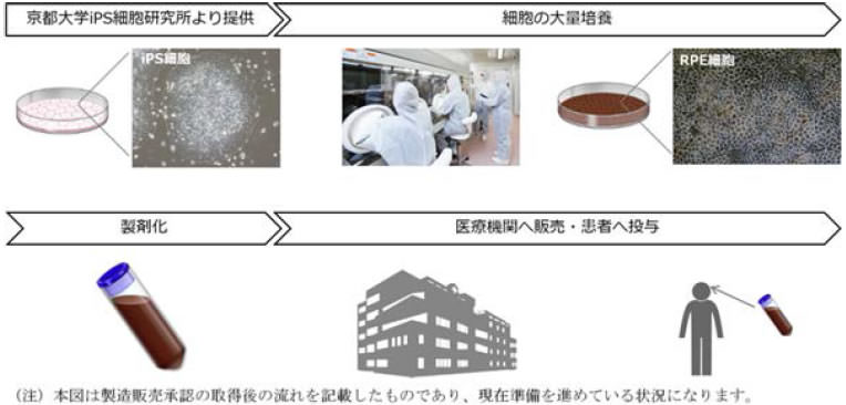 国内におけるiPS細胞の製造からiPSC再生医薬品として製剤化されたRPE細胞の罹患者への投与までの流れ